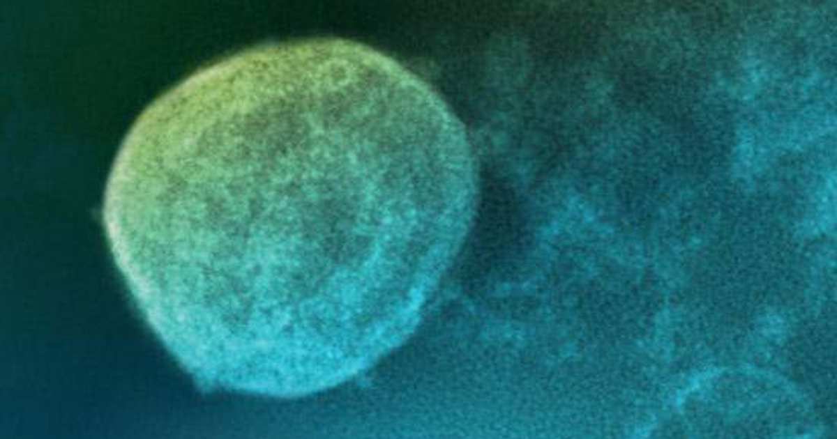 10 vírus vistos ao microscópio: do VIH ao vírus Nipah